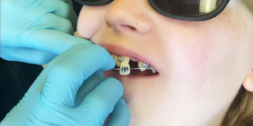 The Unexpected Psychology Behind Your Smile: How Dental Transformation Changes More Than Just Teeth