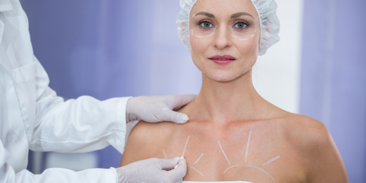 Tips for Maintaining Results After Breast Surgery in Albury