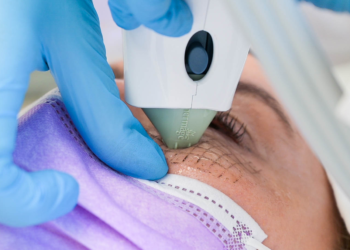 Unlock Radiant Skin with Thermage: The Ultimate Skin Tightening Solution