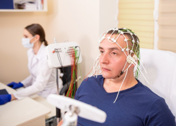 What To Consider Before TMS in Melbourne