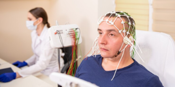 What To Consider Before TMS in Melbourne