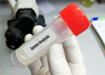 Understanding the Importance of a Sperm Test for Male Fertility