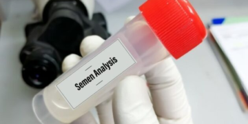 Understanding the Importance of a Sperm Test for Male Fertility