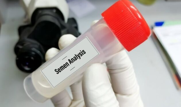 Understanding the Importance of a Sperm Test for Male Fertility
