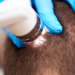 Discover the Power of Scalp Micropigmentation for Fuller Hair in Miami