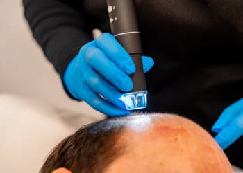 Achieving Fuller Hair Without Surgery: Scalp Micropigmentation in Miami