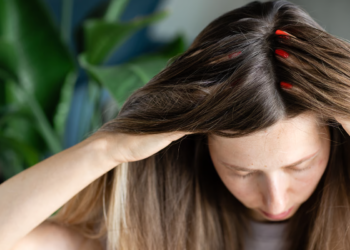 Revitalizing Your Hairline with Scalp Micropigmentation for Women in Los Angeles