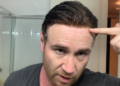 Lace Toupee Hairpiece: The Natural Choice for Modern Men’s Hair Replacement