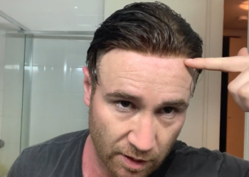 Lace Toupee Hairpiece: The Natural Choice for Modern Men’s Hair Replacement