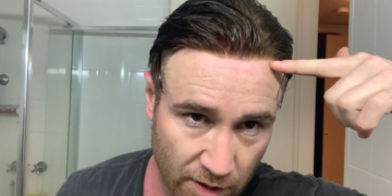 Lace Toupee Hairpiece: The Natural Choice for Modern Men’s Hair Replacement