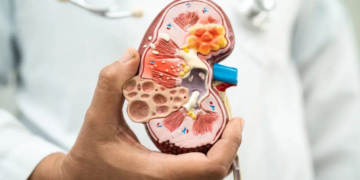 What Kidney Disease Teaches You About Taking Care of Yourself