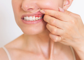 What If the First Sign of Gum Disease Isn't What You Think? The Hidden Clues Many Patients Miss Until It's Too Late