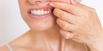What If the First Sign of Gum Disease Isn't What You Think? The Hidden Clues Many Patients Miss Until It's Too Late